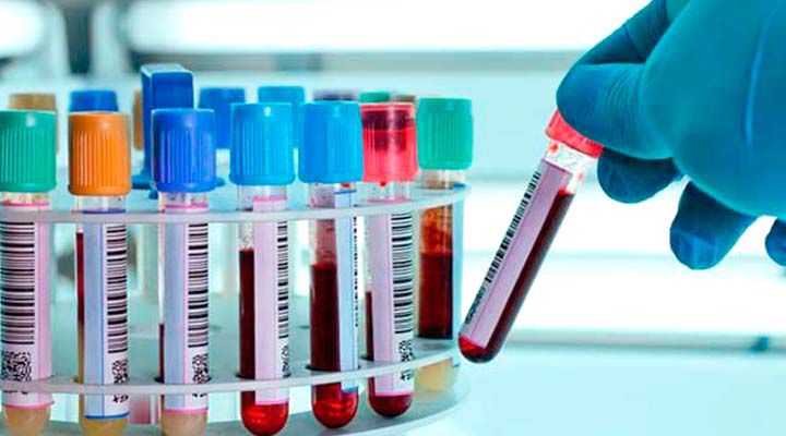 Odoo - Prueba 2 a tres columnas